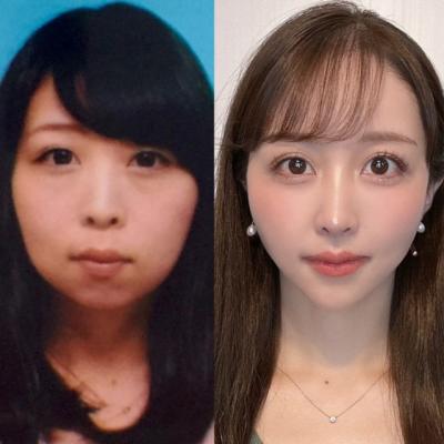 「あいつ顎ないよな」「化け物」心無い言葉が、外見コンプレックスに…整形で女性たちが得られたものとは？